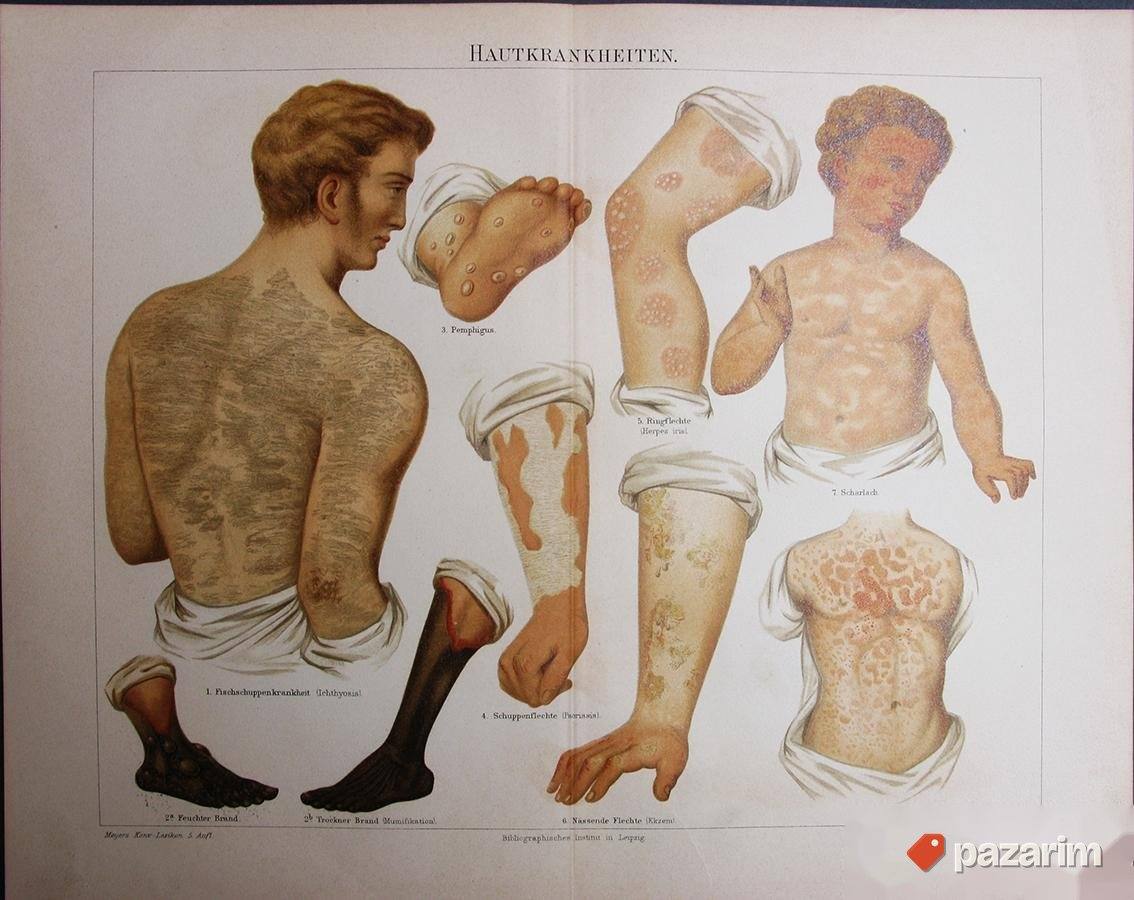 Bolesti čoveka dekorativne stare litografije 1