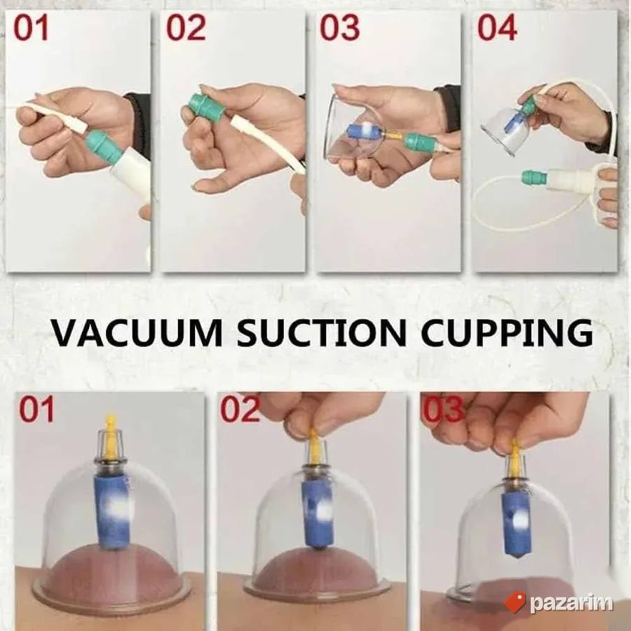 vakum terapija casama 32pc set novo 3